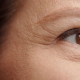 Most Preferred Laser Technologies for Eye Area Rejuvenation - Lifeplus | Nisantasi