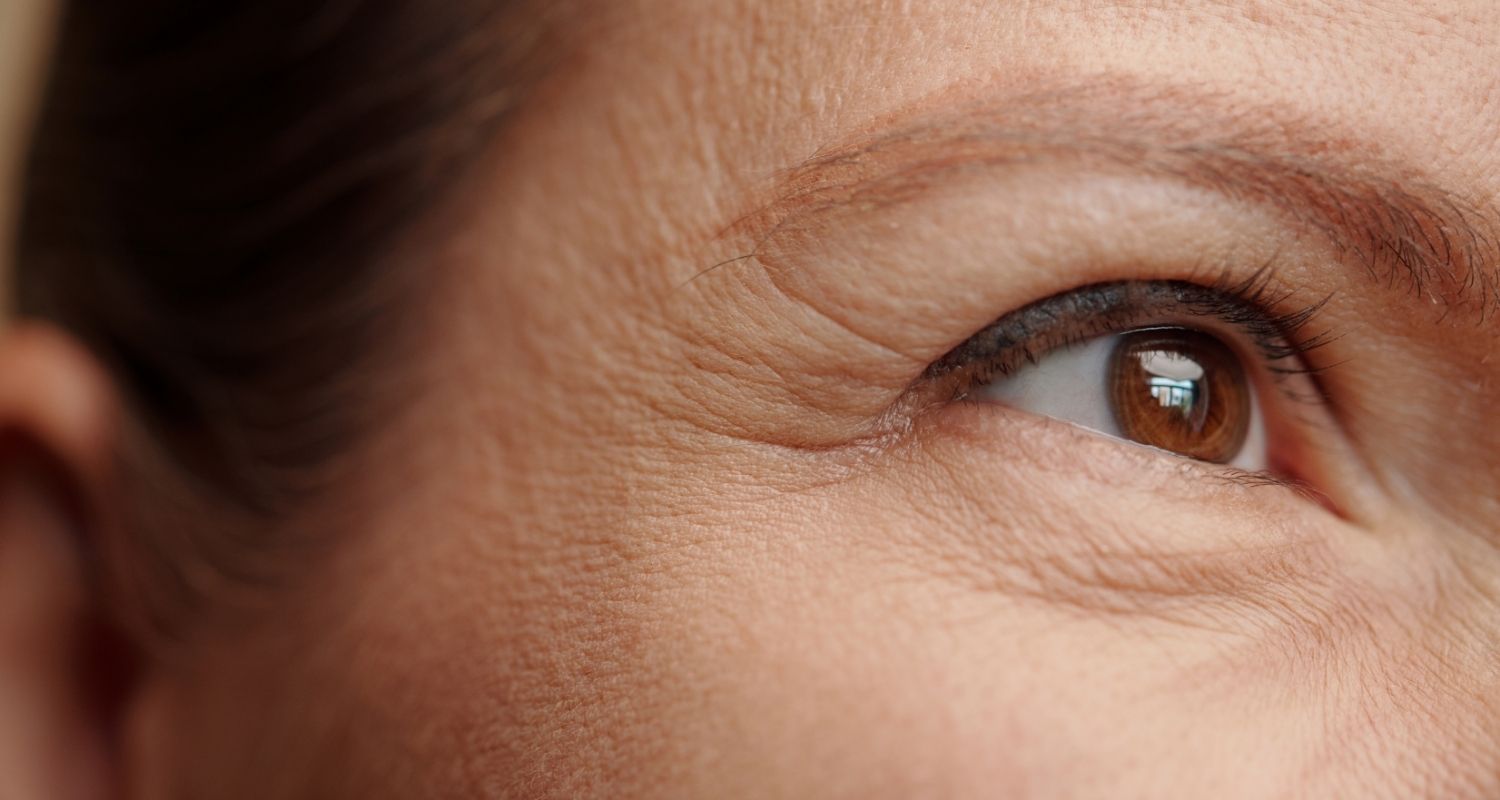 Most Preferred Laser Technologies for Eye Area Rejuvenation - Lifeplus | Nisantasi